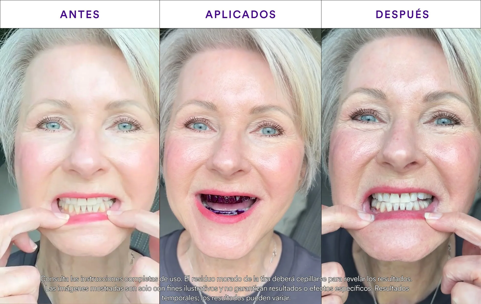 Tiras Blanqueadoras V34 - Image 6