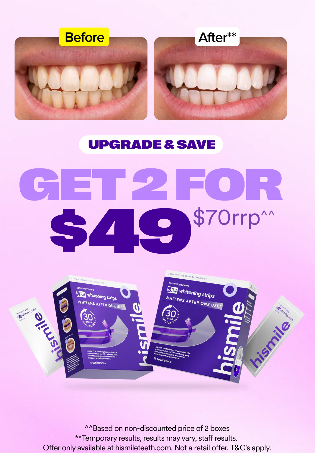 V34 Whitening Strips - Value 2 Pack - Image 3