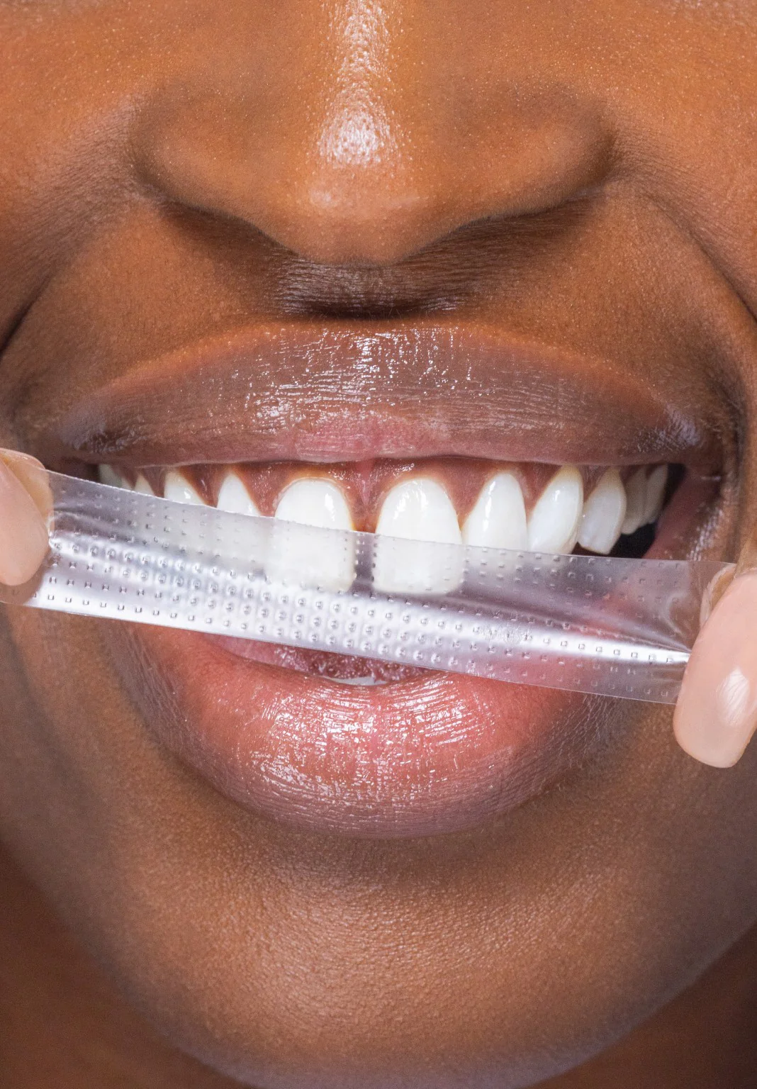 PAP+ Whitening Strips - Image 4